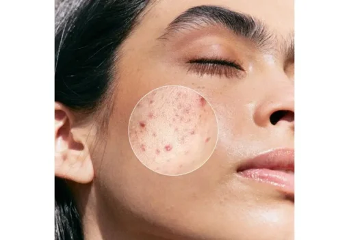 Purifying BHA Serum 30ml - Image 3